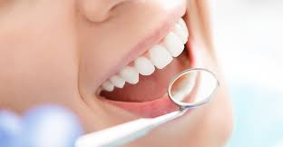Top 5 Ways Dental Bonding Can Improve Your Smile