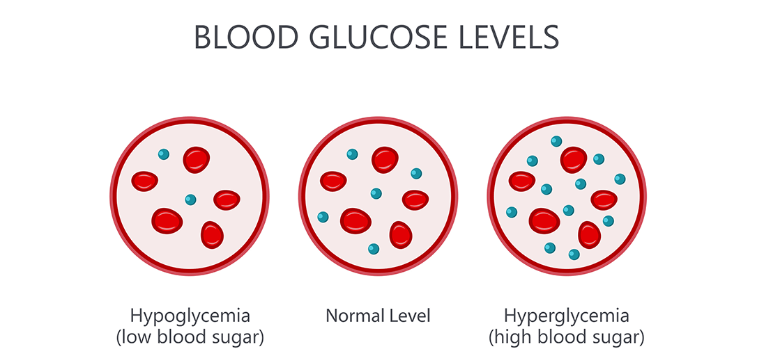 Hypoglycemia & Diabetes: What you Need to Know
