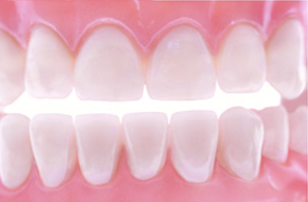 Restoring your Teeth can Restore your Confidence!